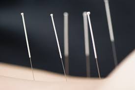 Autumnal Acupuncture Tune-Up