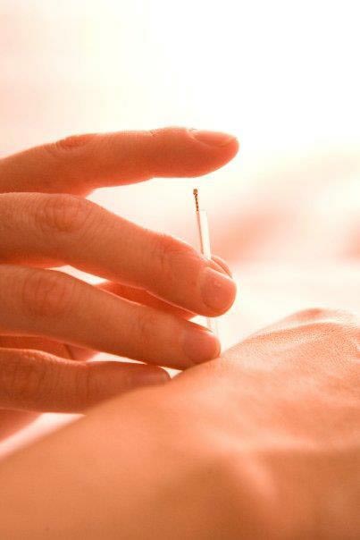 The Acupuncture 411