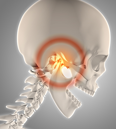 Temporomandibular Joint Disorder