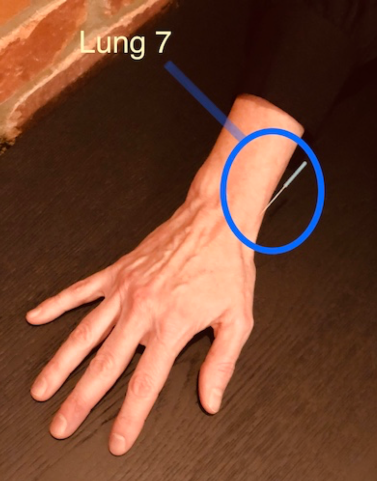 The Acupuncture Point That Will Boost Your Immune System