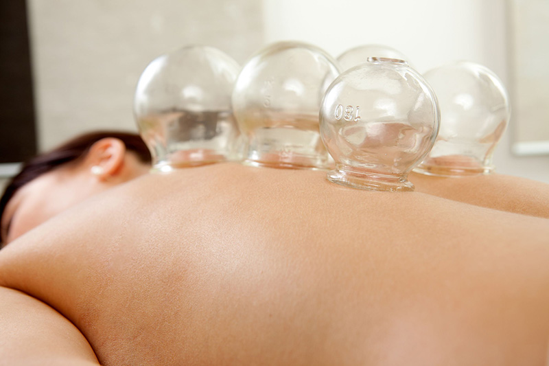 Element Acupuncture Cupping