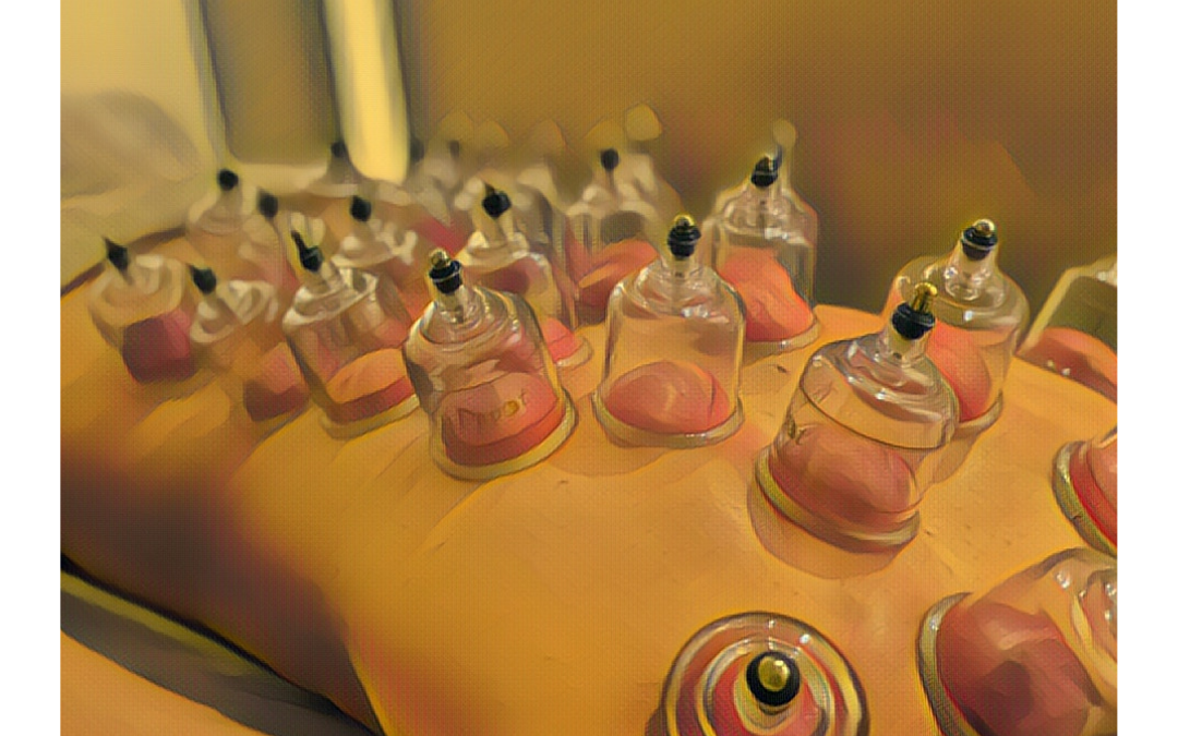 Cupping Question blog post Jan 2025