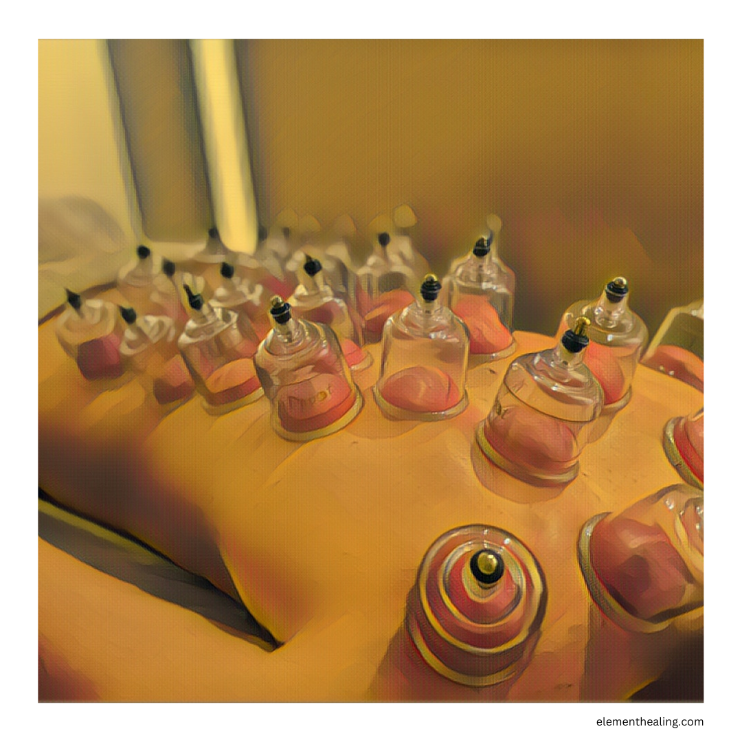 Cupping Question blog post Jan 2025
