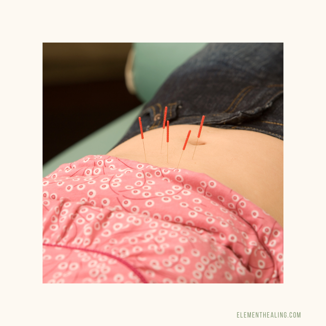 The Power of Acupuncture in Treating Digestive Issues